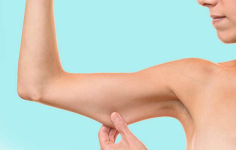 Braquioplastia