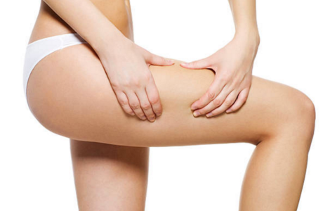 Gluteoplastia