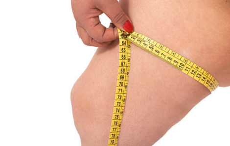 Lipectomía de Piernas